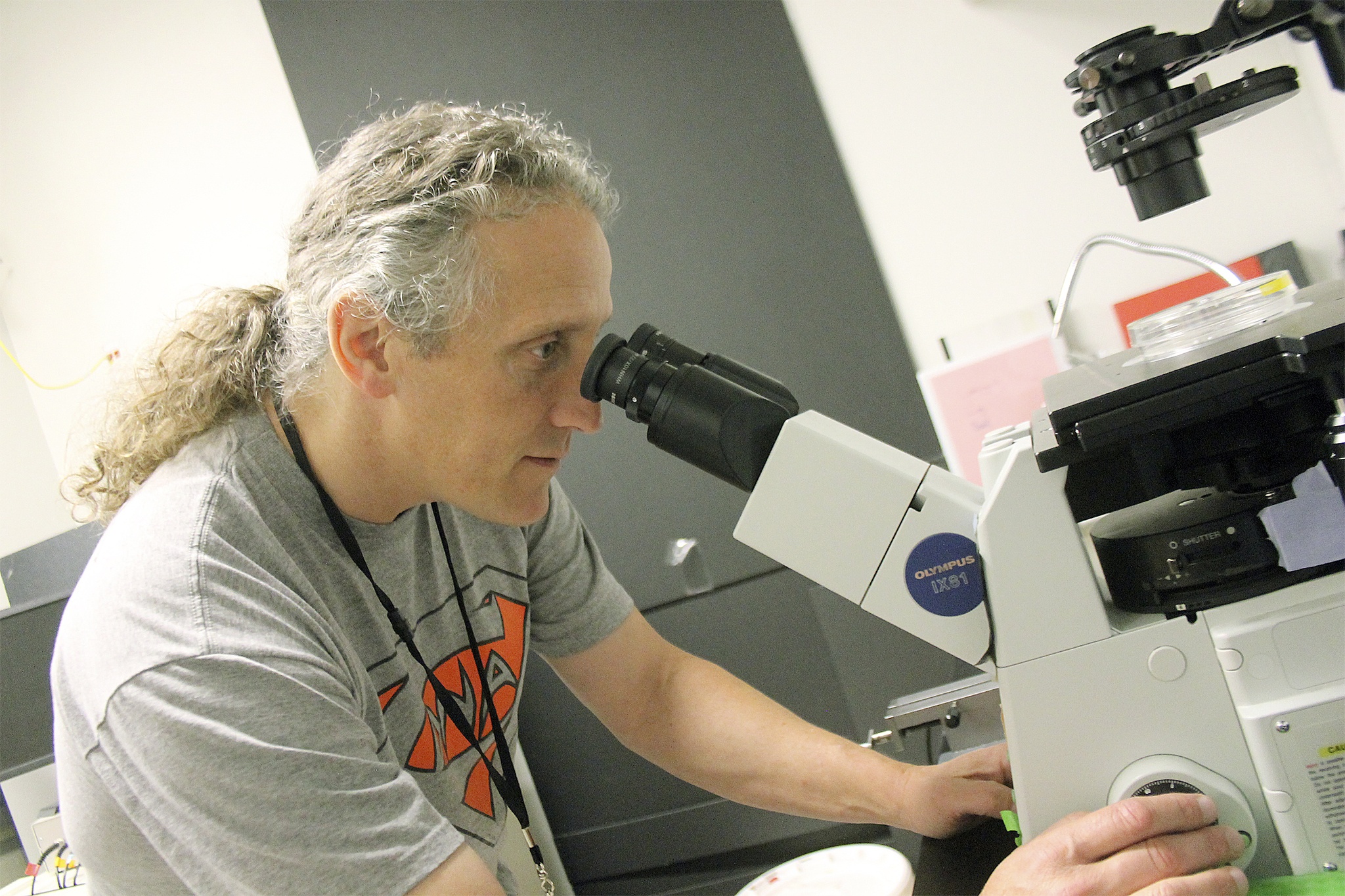 Through his summer work in a UW ophthalmology lab