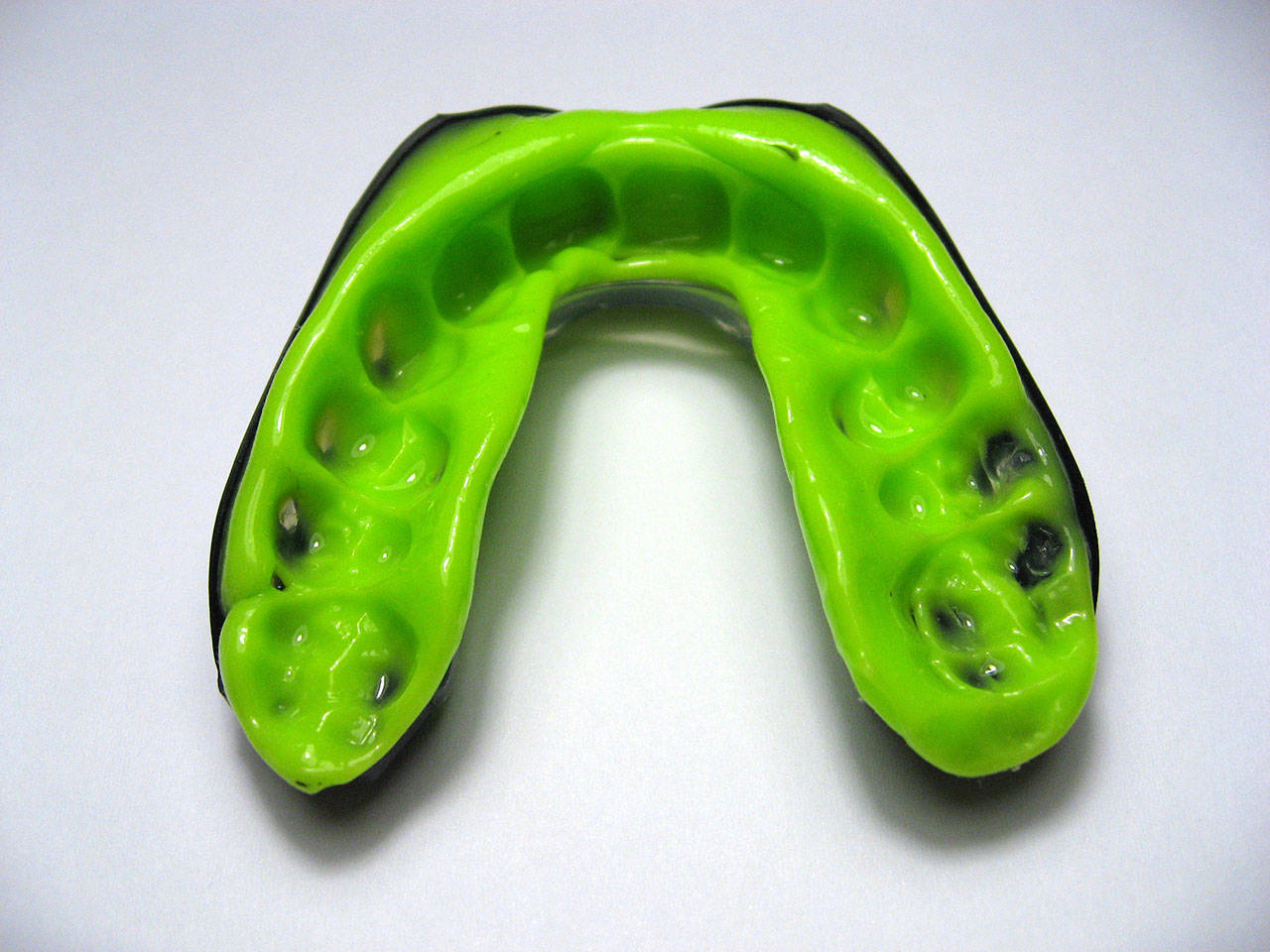 Use of a sports mouthguard can significantly reduce the incidence of dental injuries. Courtesy photo