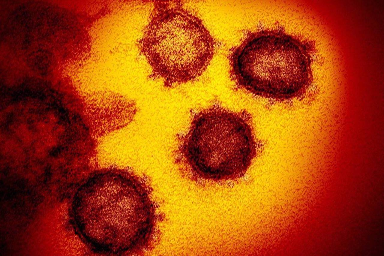 This undated electron microscope image made available by the U.S. National Institutes of Health in February 2020 shows the Novel Coronavirus SARS-CoV-2. Also known as 2019-nCoV, the virus causes COVID-19. The sample was isolated from a patient in the U.S. (NIAID-RML via AP)