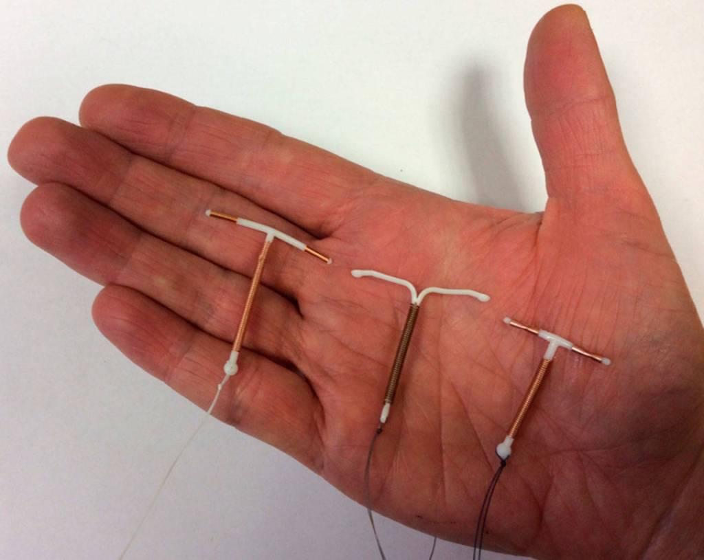 Better access to birth control means fewer teen pregnancies | My Turn