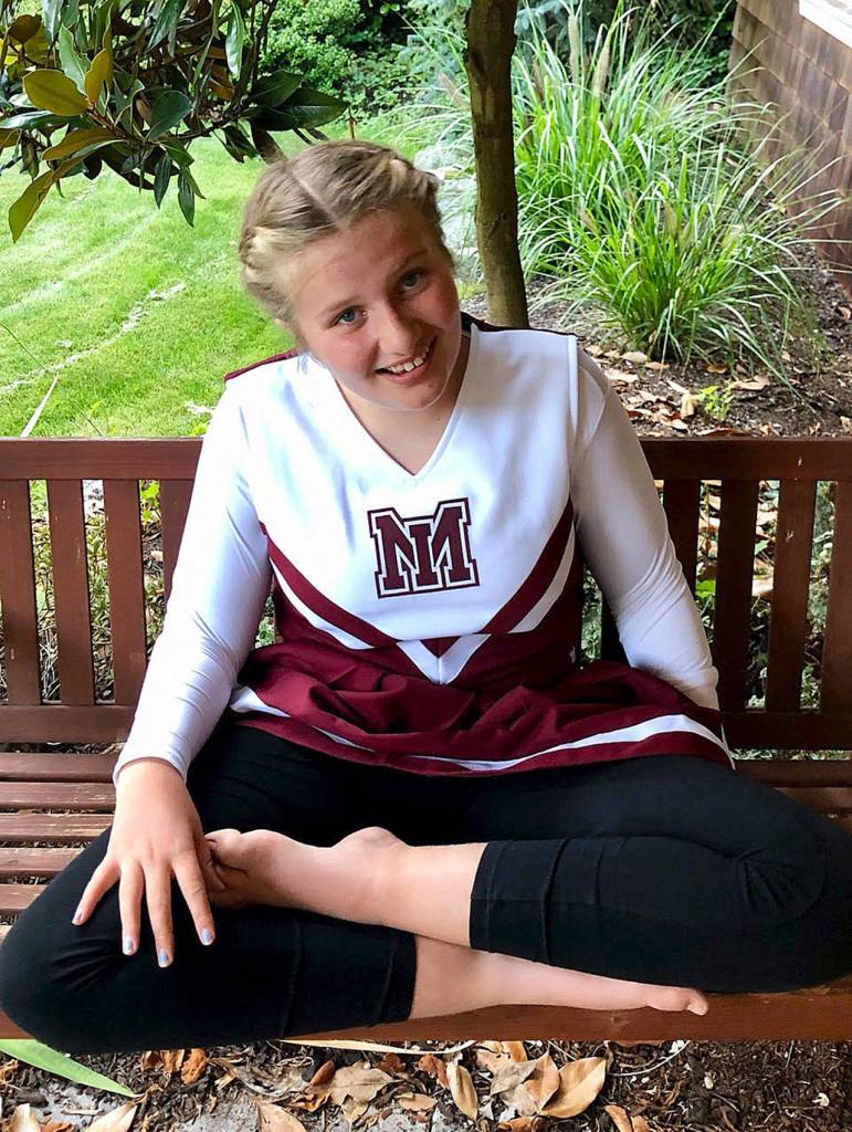 Charlotte Hawkins was born with a rare, undiagnosed disease. The UDN suspects a variant found on the FAM177A1 gene is the cause of the disease. Courtesy photo