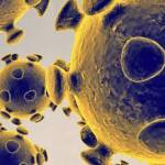 How is COVID-19 affecting Mercer Island?