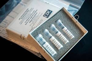 This undated file photo provided by U.S. Centers for Disease Control and Prevention shows CDCs laboratory test kit for the new coronavirus. Courtesy photo